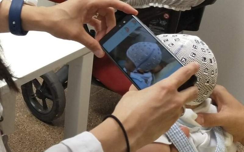 ارزیابی جمجمه نوزادان با موبایل