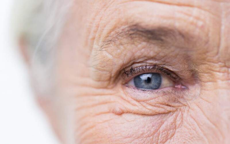 پیش‌بینی خطر بروز آلزایمر با  مردمک چشم