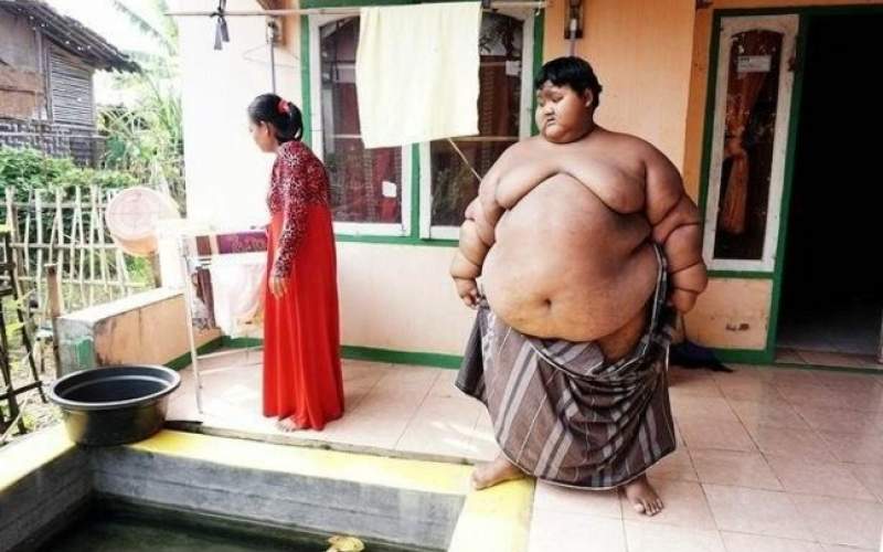 چاق‌ترین پسر جهان لاغر شد/تصاویر