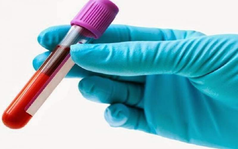 آزمایش خون برای ناهنجاری‌های ژنتیکی جنین