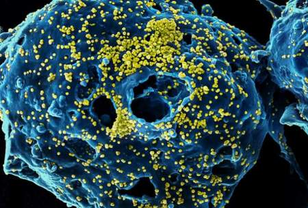 ویروس کرونا با ریه‌ها چه می‌کند؟