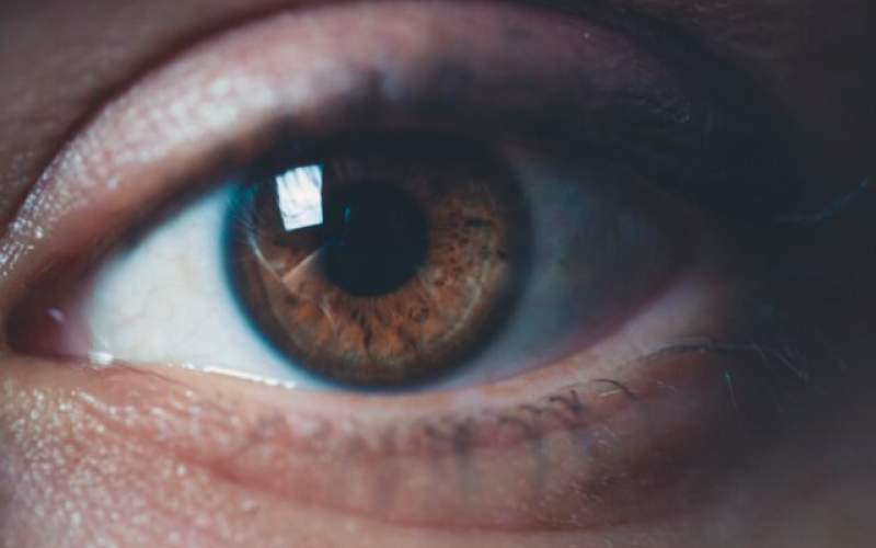 التهاب چشم هم می‌تواند از نشانه‌ کرونا باشد