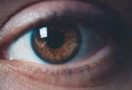 التهاب چشم هم می‌تواند از نشانه‌ کرونا باشد