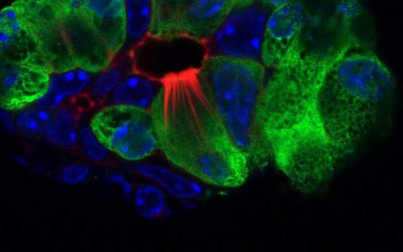 سلول‌هایی‌که به درمان‌سرطان پانکراس کمک کنند