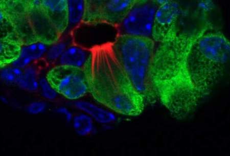 سلول‌هایی‌که به درمان‌سرطان پانکراس کمک کنند