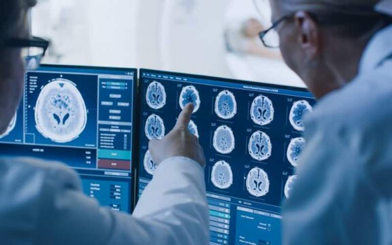 شناسایی تومور مغزی با هوش مصنوعی