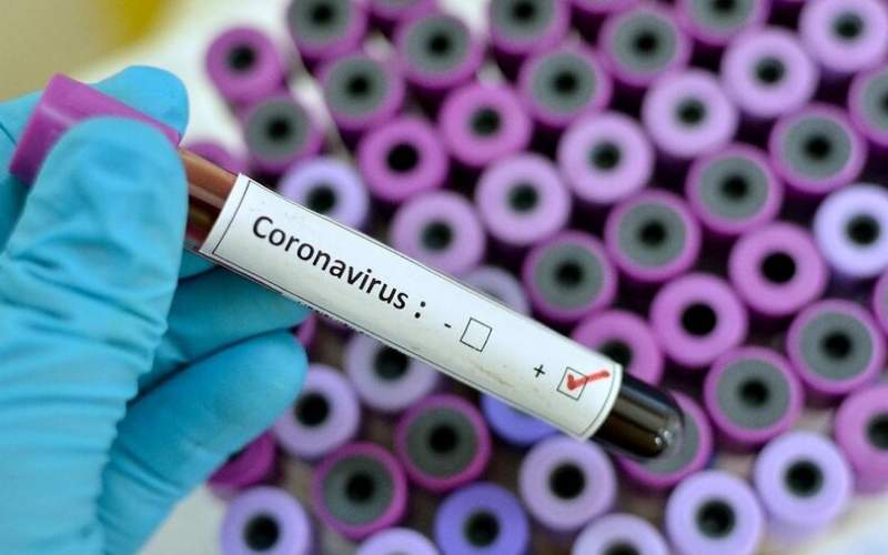 تشخیص ویروس کرونا در ۳۰ دقیقه