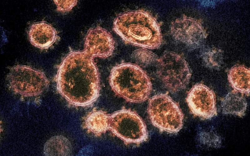 کشف روش ازبین بردن ویروس کرونا طی ۲۵ ثانیه
