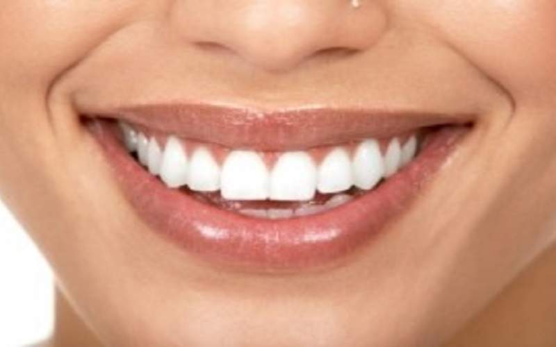 چگونه دندان‌هایی سفید و زیبا داشته باشیم؟