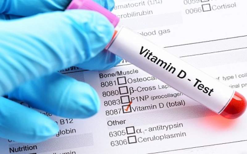 ارتباط ویتامین D با بیماری‌های روده و سرطان