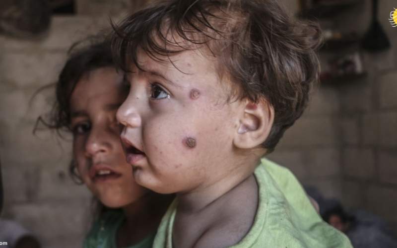 سالک؛ بلای جان کودکان آواره سوری