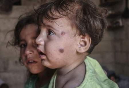 سالک؛ بلای جان کودکان آواره سوری