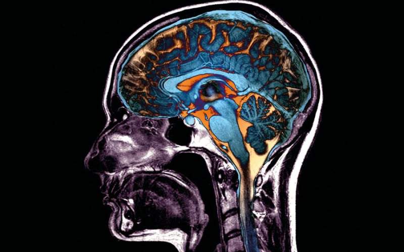 ویروس کرونا چه آسیب‌هایی به مغز می‌زند؟