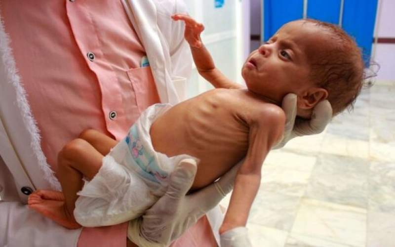 ۲۵ درصد خانواده‌های یمن در معرض گرسنگی