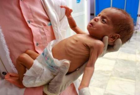 ۲۵ درصد خانواده‌های یمن در معرض گرسنگی