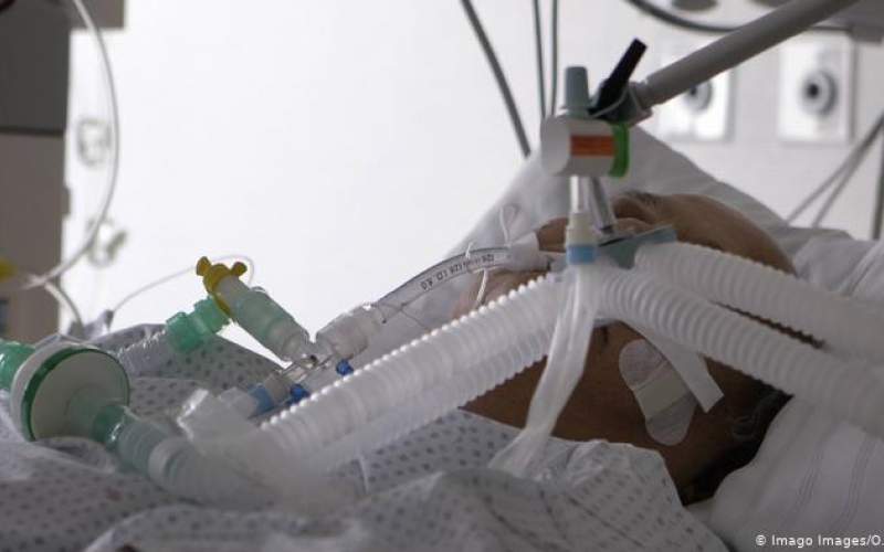 احتمال زنده ماندن بیماران كرونا با تنفس مصنوعی