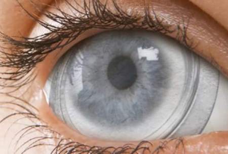 تولید پانسمان چشمی با سلول بنیادی جفت جنین