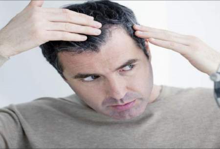 ۷ باور رایج اشتباه درباره بهداشت و سلامت مو