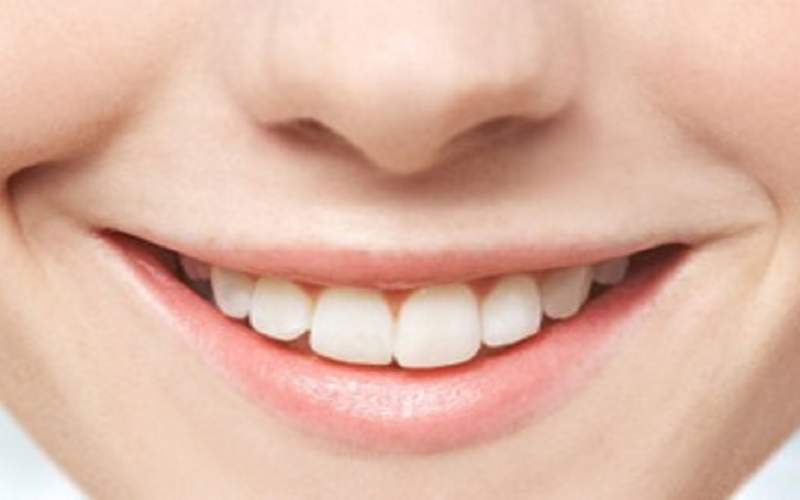 علت ساییدگی دندان‌ها چیست؟