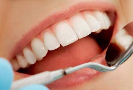 چگونه دندان درد رادرروزهای کرونایی تسکین دهیم