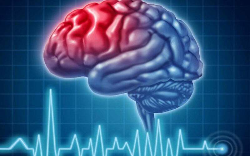 ۵ راهکار موثر برای جلوگیری از سکته مغزی