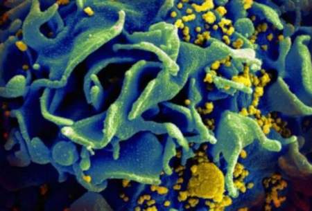 شناسایی یک التهاب جدید در افراد مبتلا به ایدز