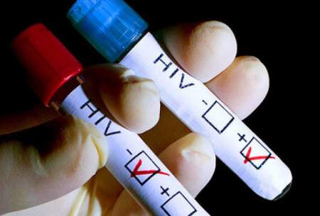 زندگی مبتلایان HIV، تحت تاثیر کرونا