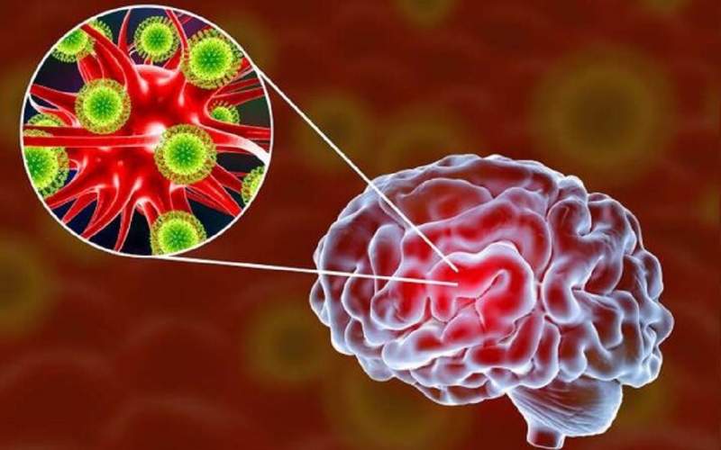 ویروس کرونا چگونه وارد مغز می‌شود؟