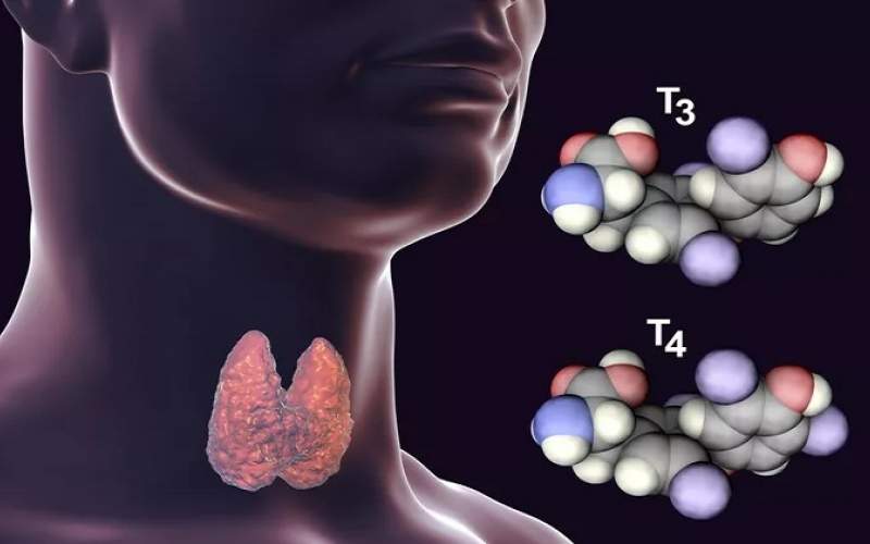 التهاب تیروئید؛ از انواع و دلایل تا درمان