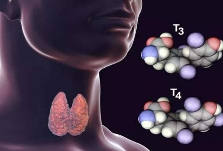 التهاب تیروئید؛ از انواع و دلایل تا درمان