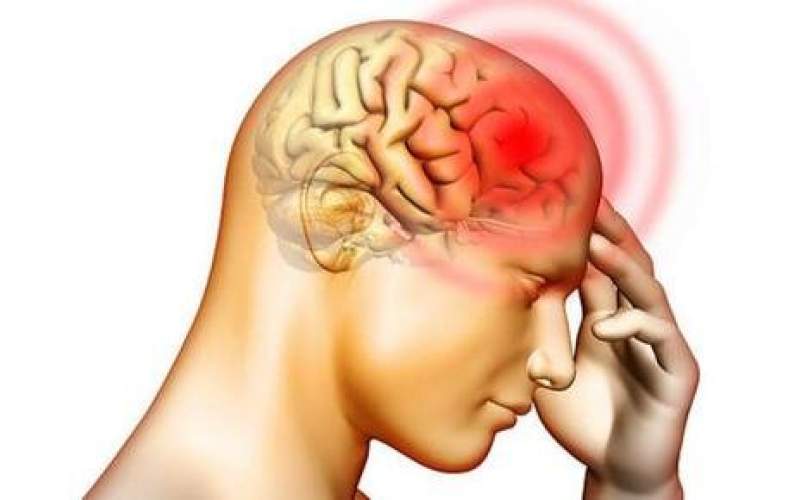 مرگ در کمین مبتلایان آنوریسم مغزی