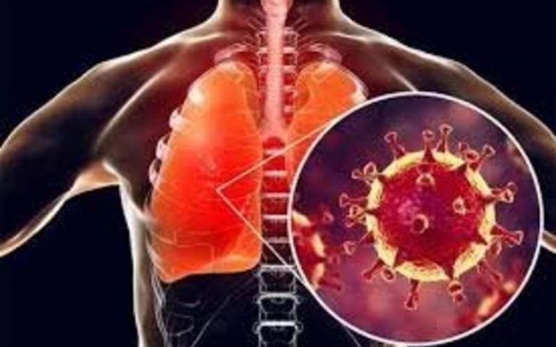 عوارض کروناویروس بر ریه چقدر است؟