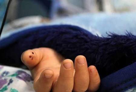 مرگ کودک مصدوم گلدره‌ای در راه بیمارستان