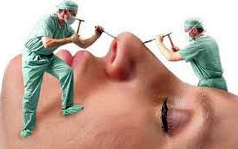 حداقل سن جراحی بینی چقدر است؟