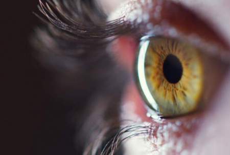 استفاده از سلول‌ بنیادی جسد برای درمان نابینایی