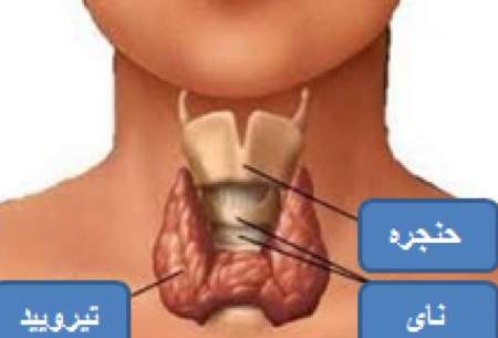 اگر این ۷نشانه را حس کردیدحتما تیروئید دارید