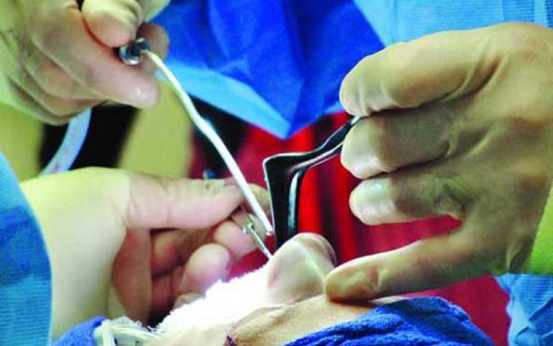 سرانه بالای جراحی بینی در ایران