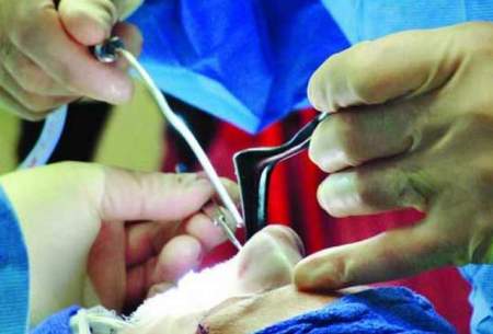 سرانه بالای جراحی بینی در ایران