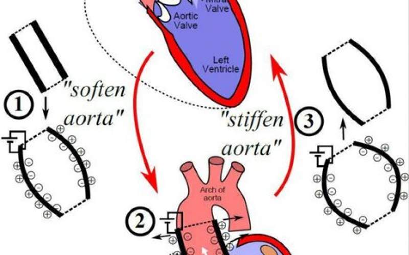 محققان سوئیسی‌ آئورت مصنوعی ساختند