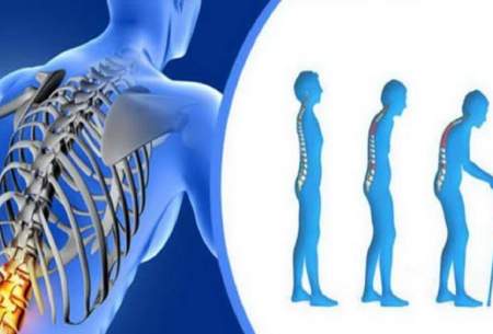 شایع‌ترین بیماری استخوان و مفاصل را بشناسید