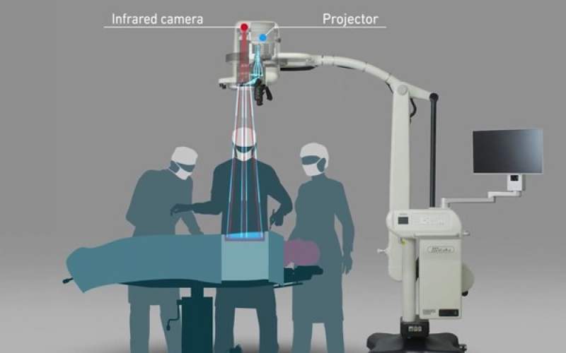 ابداع دوربین فیلم برداری زنده از جراحی بیماران