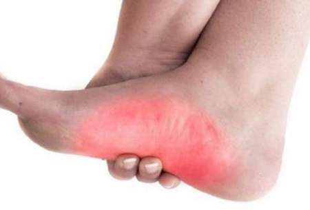درمان‌های خانگی ساده،اما موثر در تسکین پا درد