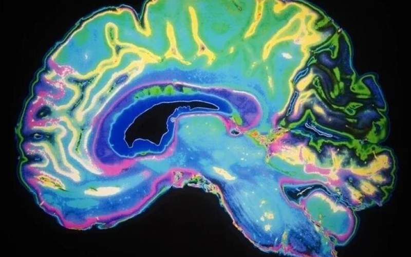 درمان بهتر آلزایمر با کمک حسگر مغزی