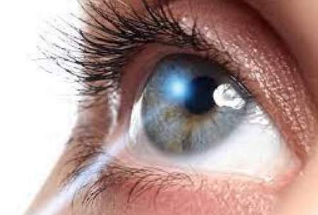 چشم؛‌دریچه‌ای برای تشخیص بسیاری از بیماری‌ ها