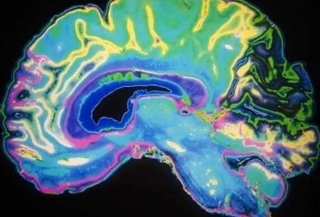 نرم‌کننده‌ها و اختلال عملکردهای مهم مغز