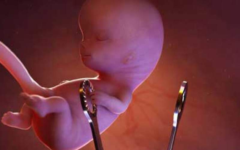 سقط درمانی جنین ناقص‌الخلقه اجباری نیست
