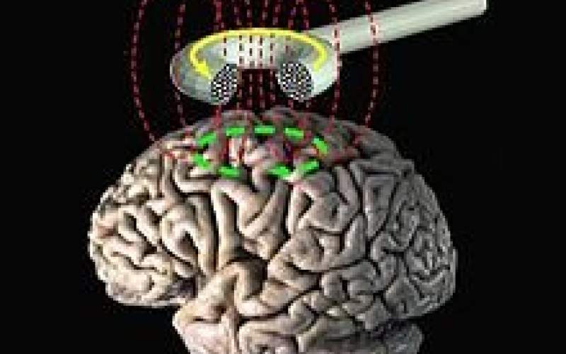 کنترل اشتها با هدف قرار دادن یک گیرنده در مغز