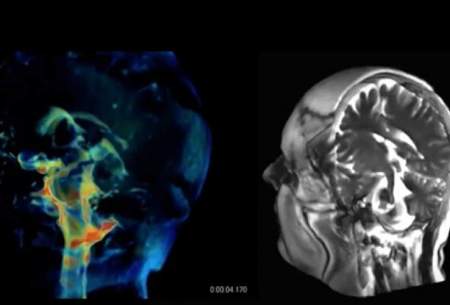 فناوری جدیدی برای تصویربرداری ۳بعدی از مغز