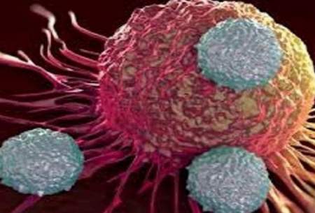 کشف روشی جدید برای درمان سرطان سینه
