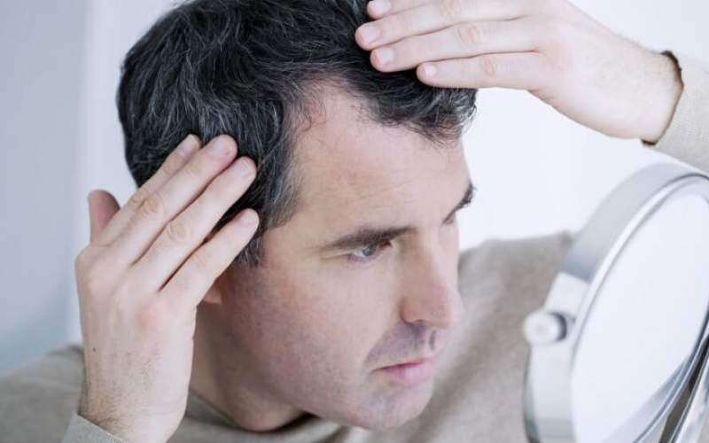 درمان سفیدی و ریزش مو با چند ترفند ساده